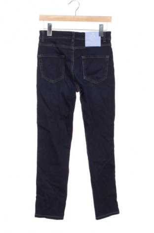 Damen Jeans TWINSET, Größe XS, Farbe Blau, Preis 35,99 €