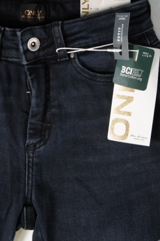 Damen Jeans ONLY, Größe XXS, Farbe Blau, Preis 8,76 €