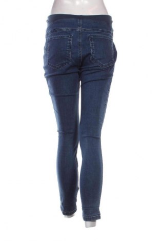 Női farmernadrág Calzedonia, Méret M, Szín Kék, Ár 5 119 Ft