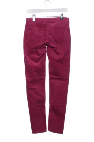 Kinderhose United Colors Of Benetton, Größe 14-15y/ 168-170 cm, Farbe Rosa, Preis € 23,05
