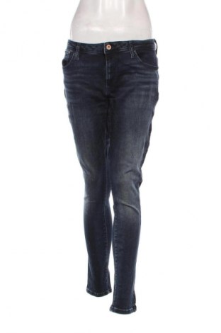 Damen Jeans ONLY, Größe M, Farbe Blau, Preis 17,39 €